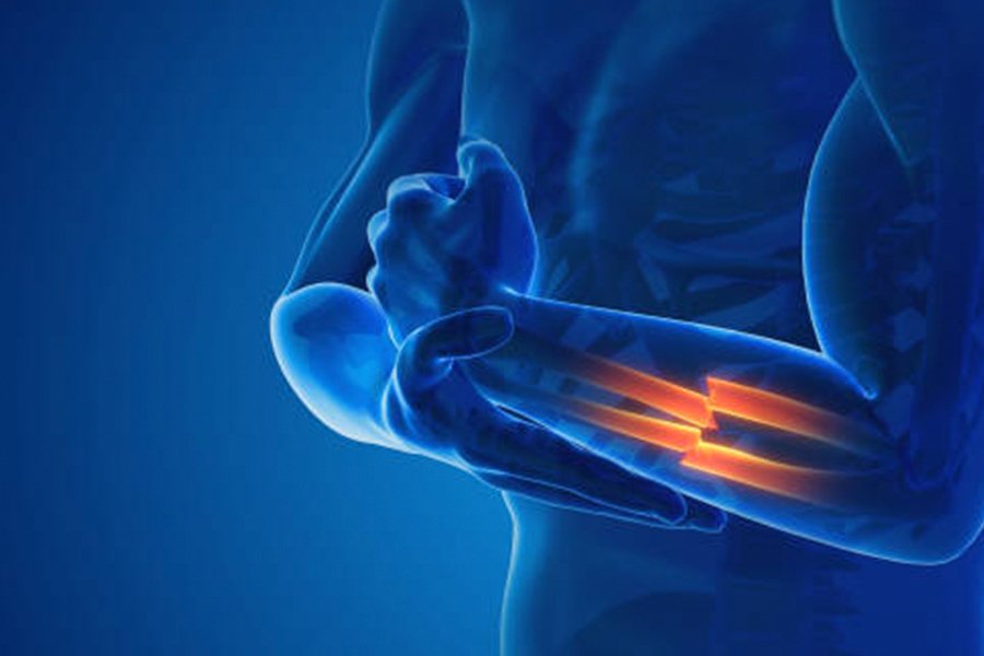 Expert Care for Laser Therapy in Dearborn & Pontiac