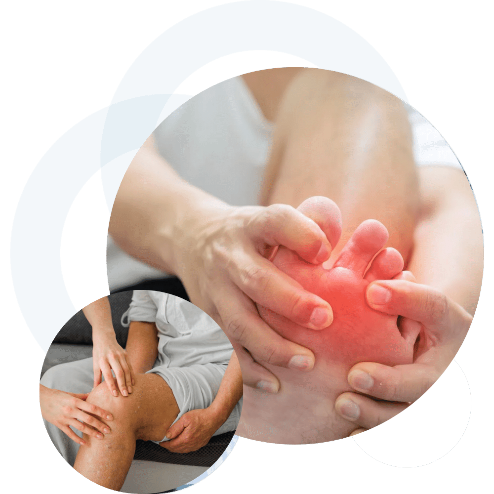 Specialized Gout Care in Dearborn